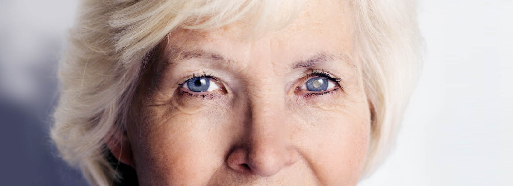 Cataract Surgery in Hilliard
